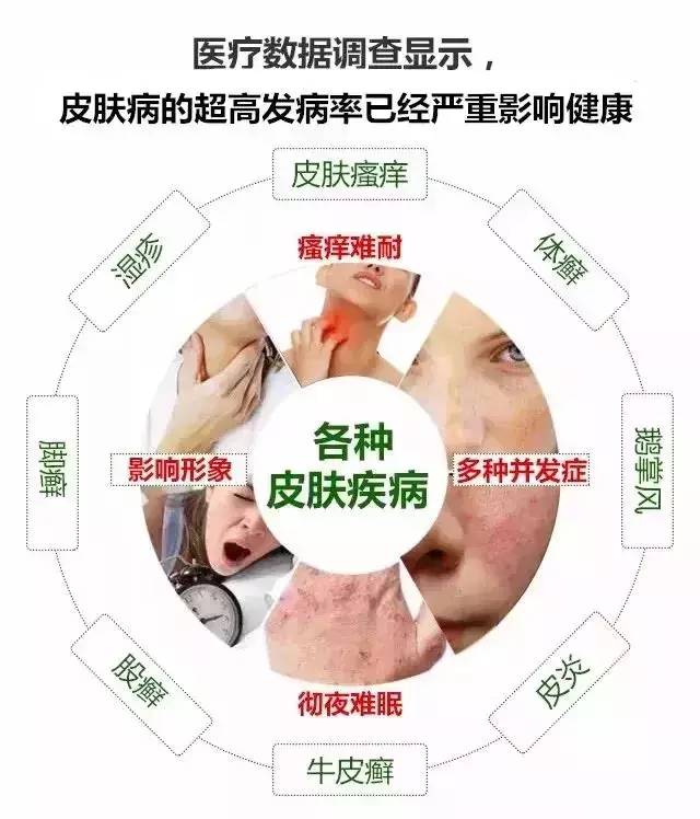 湿疹，顽癣，皮炎等皮肤问题，教你一招，轻松根治！