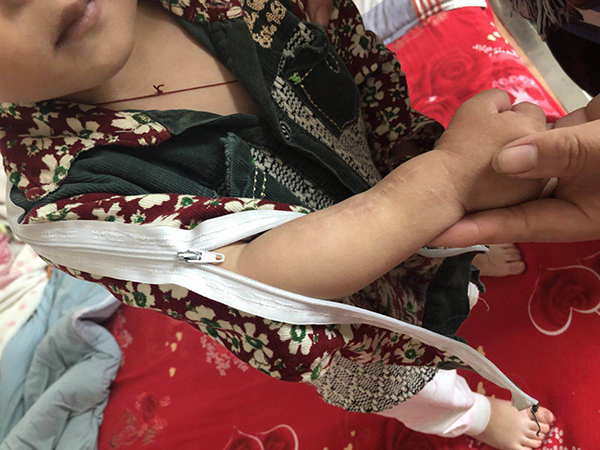 产瘫男婴医疗案二审:父亲乞讨求医 曾判医院全责