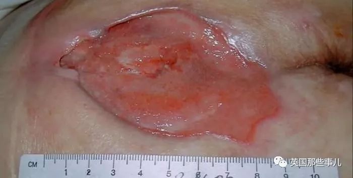 体重六七百斤，床都下不了。 他们，成了肥肉的囚徒…