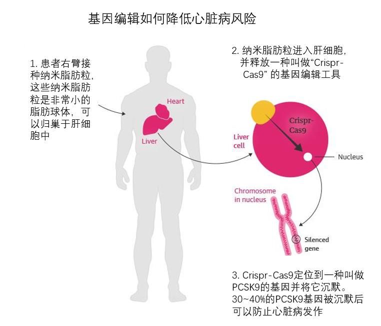 福音！心脏病预防针来了，打一针就可永久预防？这真不是传闻…