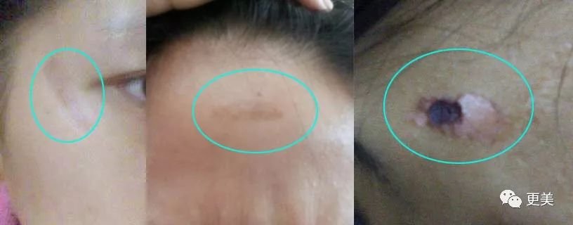 20岁小花跟baby争一姐，身高和沈月一样虐，换头后鼻子宽成阿凡达！