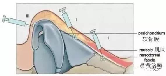 20岁小花跟baby争一姐，身高和沈月一样虐，换头后鼻子宽成阿凡达！