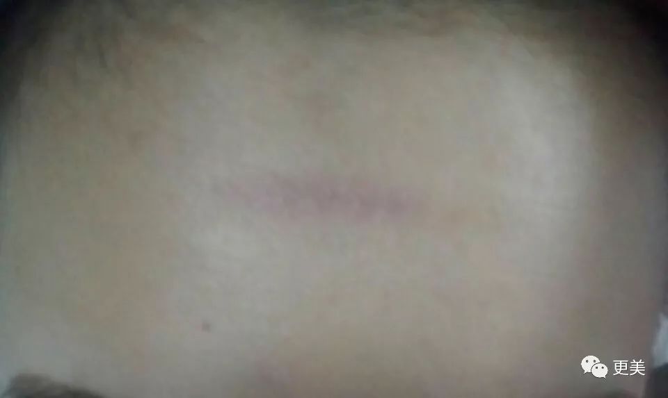 20岁小花跟baby争一姐，身高和沈月一样虐，换头后鼻子宽成阿凡达！