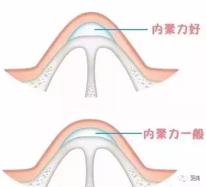 20岁小花跟baby争一姐，身高和沈月一样虐，换头后鼻子宽成阿凡达！