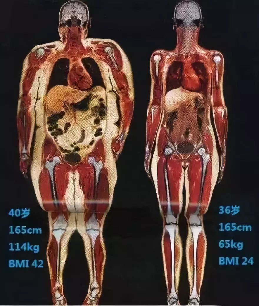 120斤的刘涛身材依然在线？你需要了解一下这则减脂攻略！