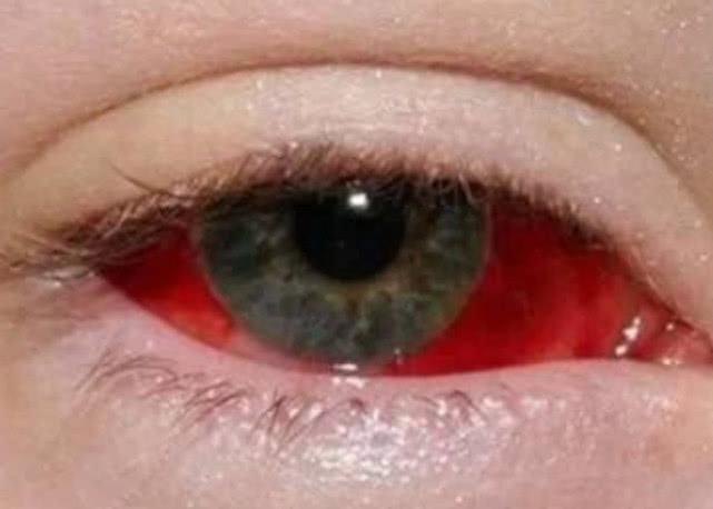 情感测试:选一只最可怕的眼睛,测出你在男生眼里是什么形象?准
