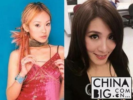 又一对隐形离婚！为帮老公捞金不惜公开整容，男方出轨15次？