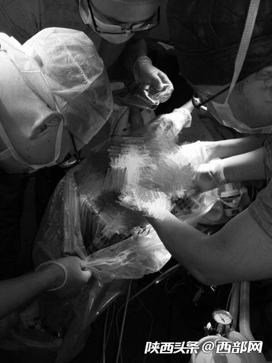 男博士讲述被熊袭击后自救过程：报警止血找水源