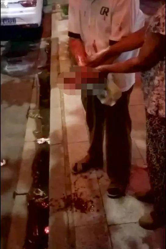噔的一声,爆炸了,四个指头没了,手心炸烂了