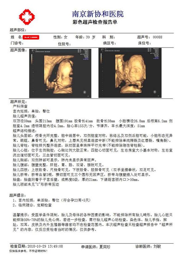 南京新协和医院:关于四维彩超在产检大排畸中的应用