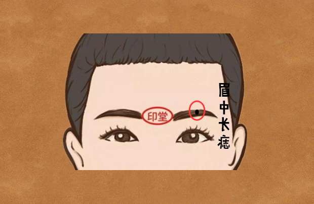 巨富痣,身体5大吉痣,财大气粗,个个腰缠万贯,家财不动产多!