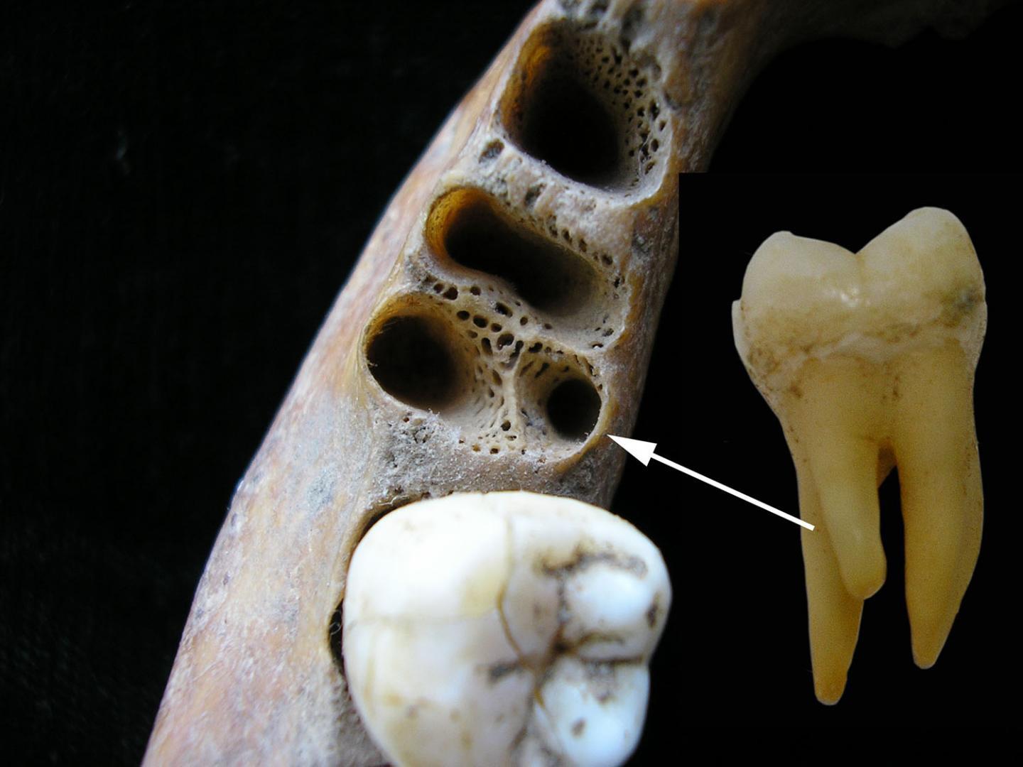 古臼齿提供亚洲古人类与智人杂交的证据