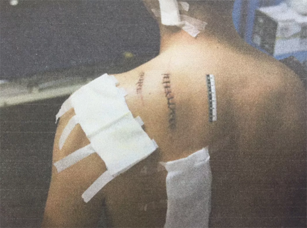 醉酒男子公共场所持刀行凶伤7人 一审获刑12年