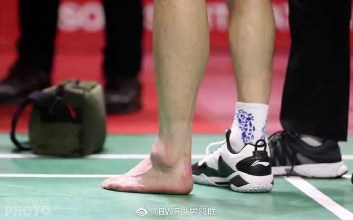 脚踝肿得像包子 石宇奇崴脚伤退恐影响奥运积分赛