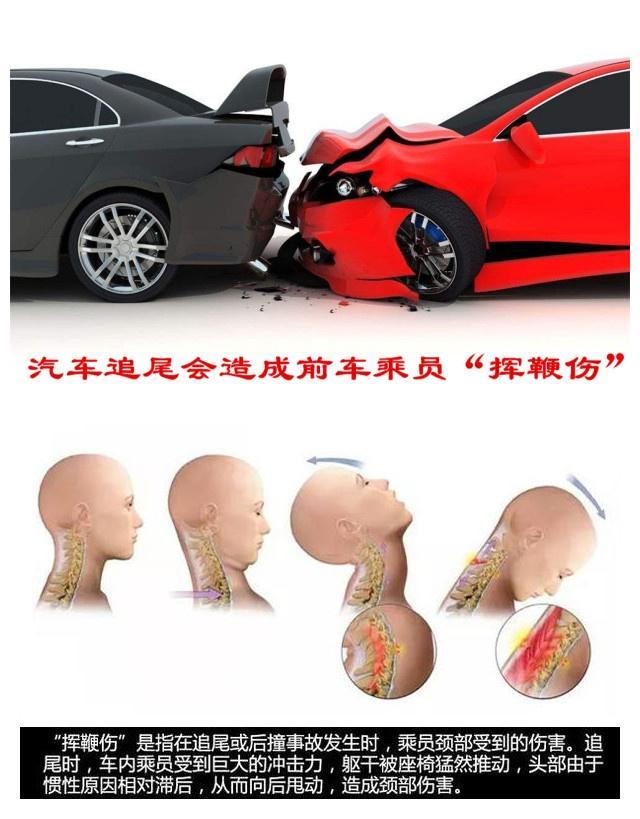 汽车的头枕究竟有什么用?它能提升汽车的安全性能吗?