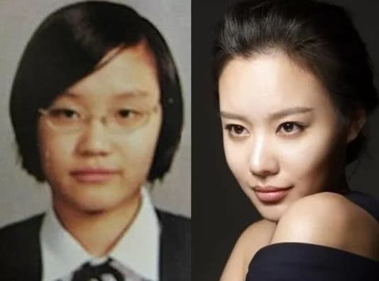 还记得《丑女大翻身》的女主金雅中吗？她又换脸了