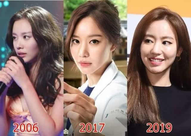 还记得《丑女大翻身》的女主金雅中吗？她又换脸了