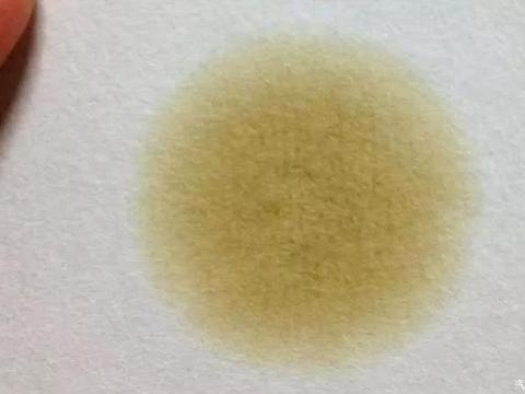 快速自查油液系统，其实非常简单，谈谈一些技巧