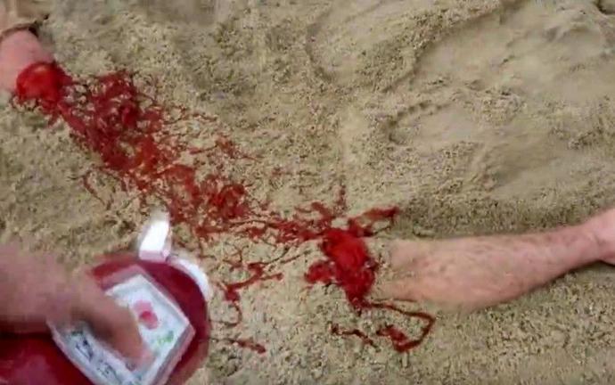 沙滩上一男子腿断了,周围都是血!让周围人都无奈了!