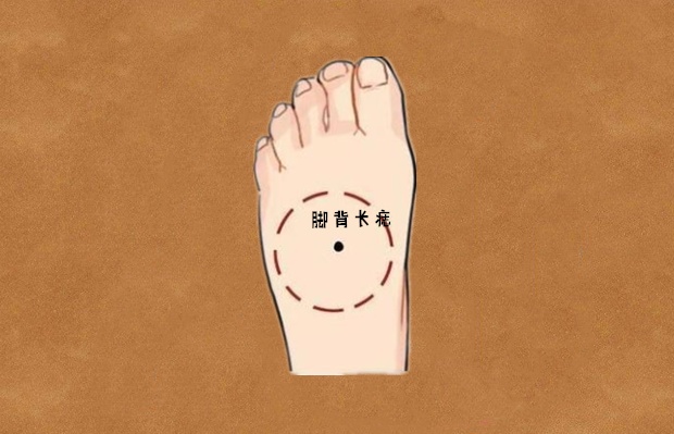 痣,此处长痣,财运