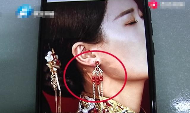 新婚小两口婚纱照成片看着“伤痕累累”！工作人员：这没问题
