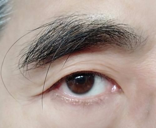 眉毛长是寿命长的表现吗?眉毛的2种表现,或许是身体疾病的信号