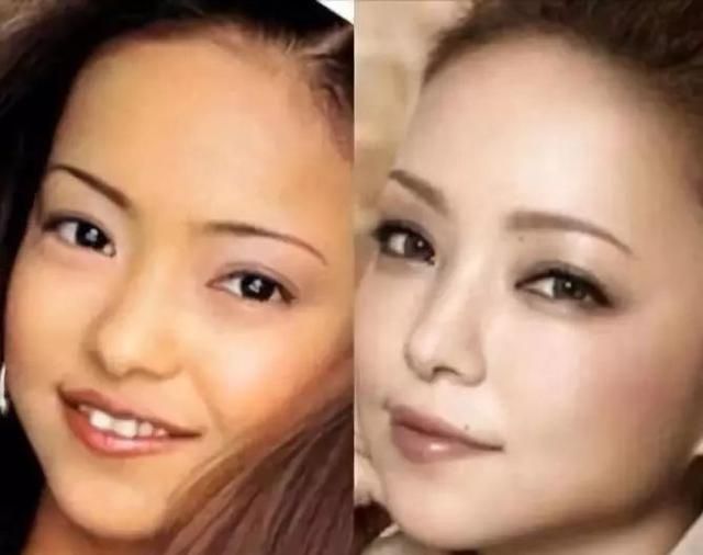 已经长得很好看了，为什么还要去整鼻子？