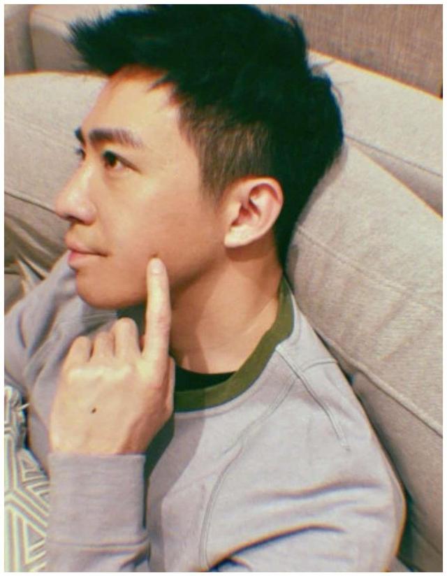 毁容后孙俪因祸得福，胡歌伤疤明显，她毁容后5次整容撞脸赵丽颖