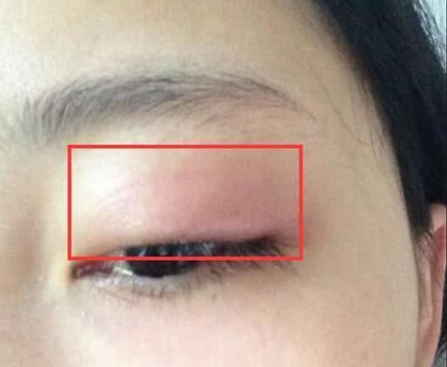 中学生早上起床有这3种现象 说明肾在 走下坡路 别羞于