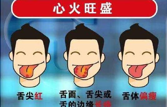 早上起床后,出现口干、口苦、口臭,可能身体有三大问题,莫忽视