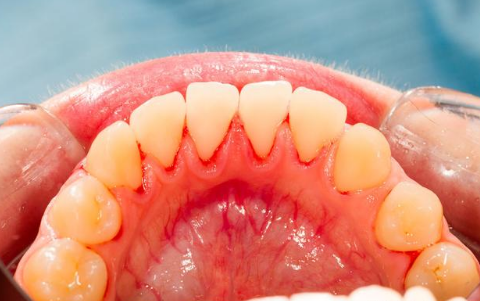 珠峰三轮摩托车后桥牙包里边是用哪种润滑油?