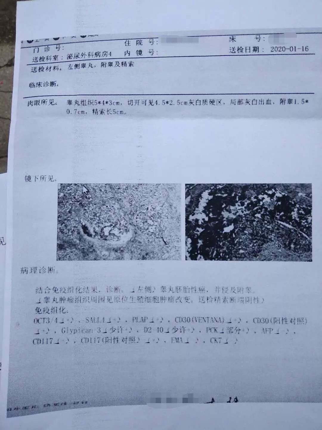 阅读约需2分钟  随州癌症患者家属反映,随州及武汉多家医院肿瘤科室因
