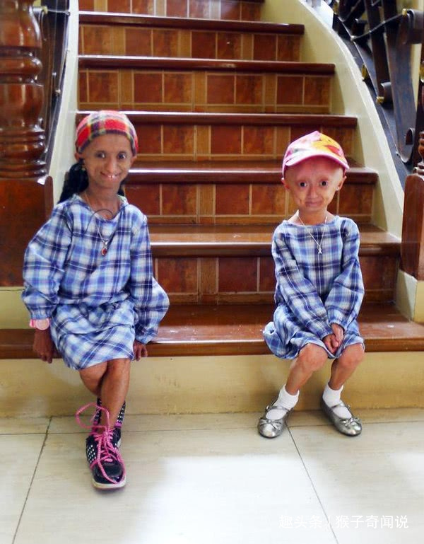 卵巢早衰主要原因 怎样预防卵巢早衰