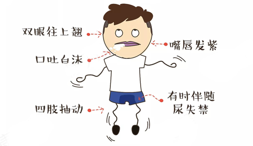 产后癫痫:坐月子羊癫疯发作,会影响宝宝吗?