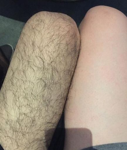 为什么有的男生腿毛稀少,有的男生却非常浓密?
