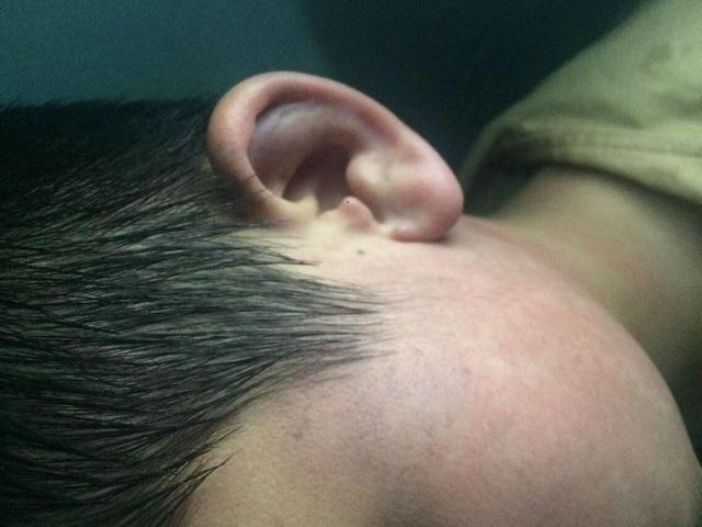 孩子为什么会患中耳炎?大多由这4种因素