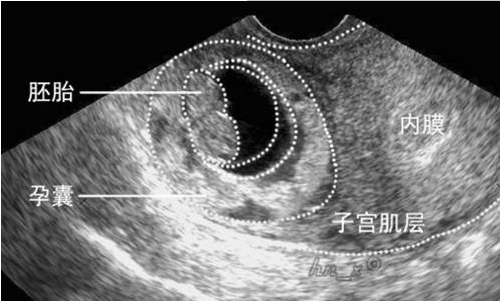 分享怀男宝与怀女宝的区别, 让你一眼看出来你怀的是男孩是女孩