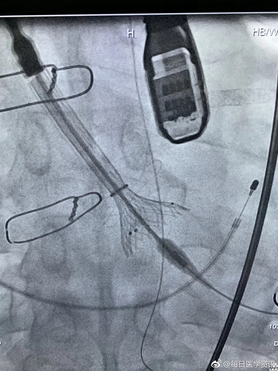 马桶水箱放洁厕块安全吗 蓝色洁厕块污染自来水真相