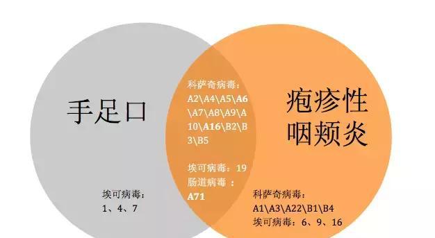 手足口、疱疹性咽颊炎多地爆发，孩子有这 4 个症状赶紧就医