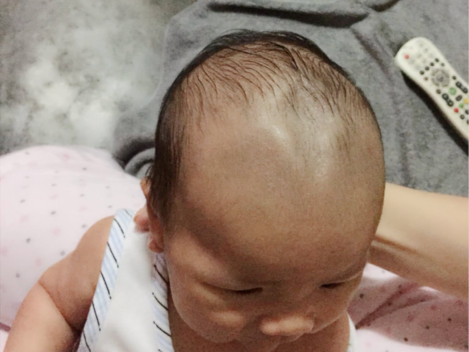 6个月宝宝囟门闭合,家长惊慌失措,多种现象的