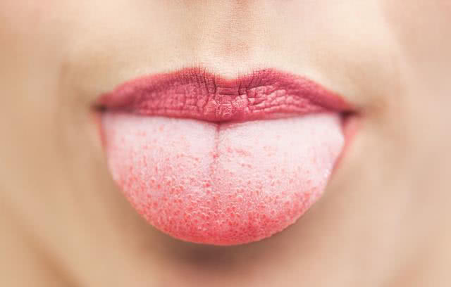 4种人,舌癌更容易找上你,快自测一下