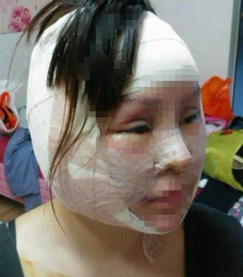女孩从小就整容，高额费用整容200次，现在医生看着都疼
