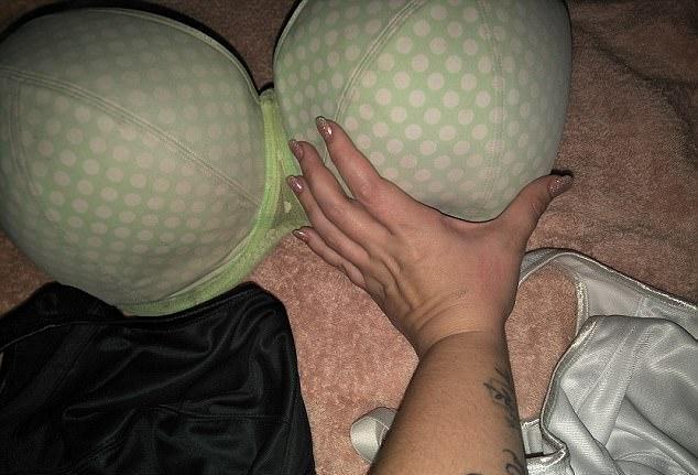 23岁女子因乳房过大感到困扰, 不得不进行缩胸手术