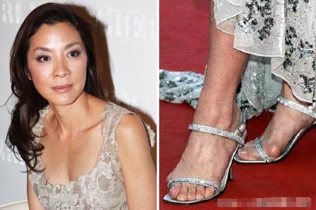女星脚太丑: 杨紫琼宋茜畸形, 王子文满是伤疤, 金星为脚骄傲