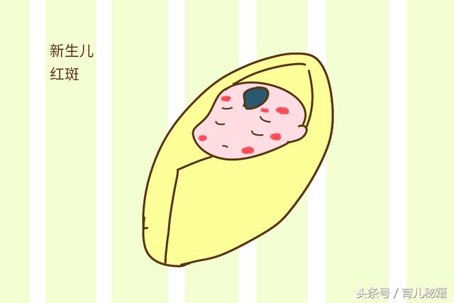 正文        新生儿红斑也就是俗称的新生儿荨麻疹,是一种新生儿常见
