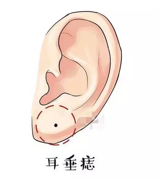 耳朵也可看命运,耳朵这几个地方有痣将有帝王命,大富