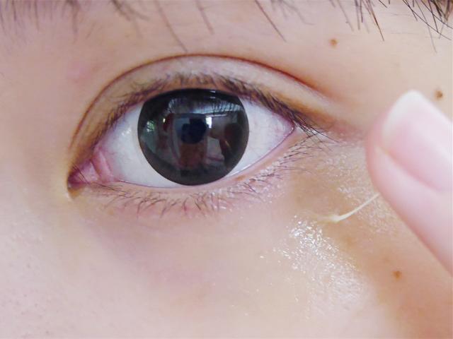 眼睛下面长白色小颗粒? 教你1绝招, 快速去除不