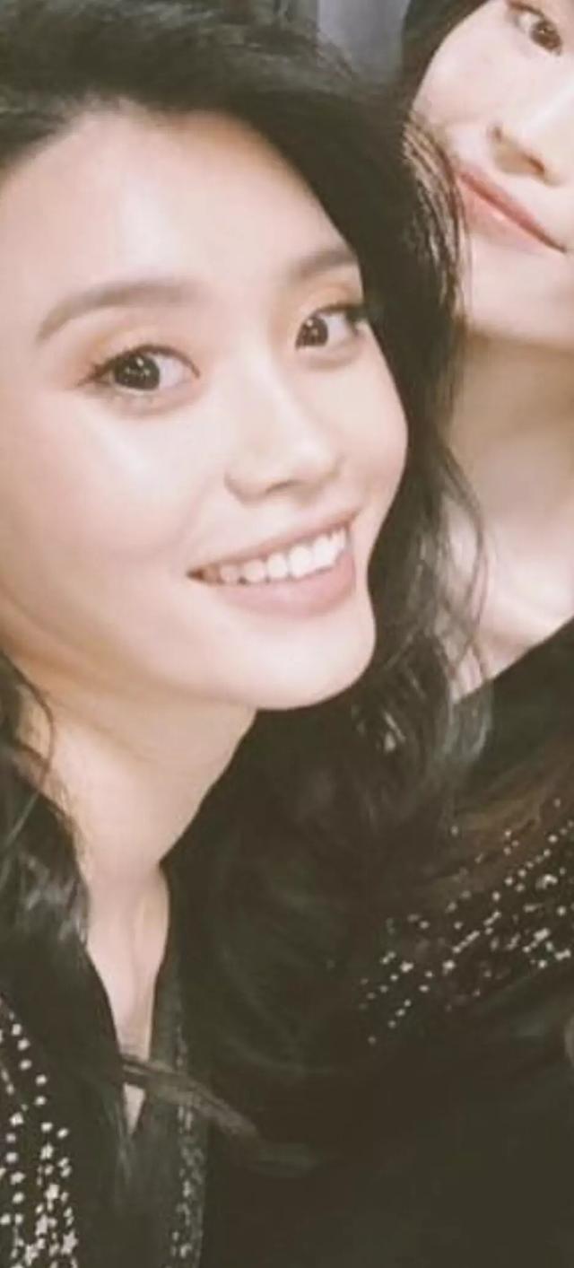 奚梦瑶ins发合影不给自己P图,腮帮子填充太过