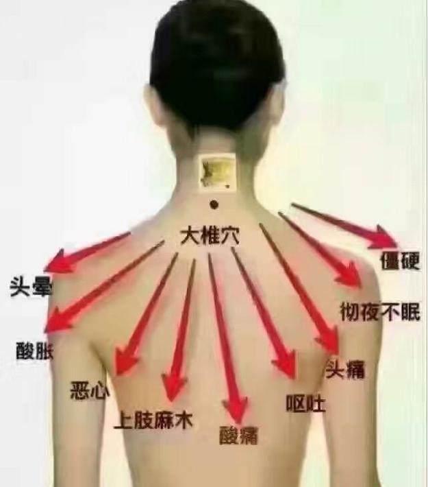 患了颈椎病不要怕, 这些锻炼方法简单有效, 不花