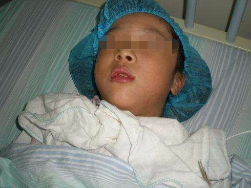 9岁男孩嘴里总长水泡,医生检查后,把他舌头切